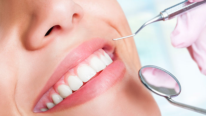 Gesetzlich versichert: Wann ist eine private Zahnzusatzversicherung empfehlenswert? | Private Zahnzusatzversicherung: Ergänzung zur gesetzlichen Krankenversicherung